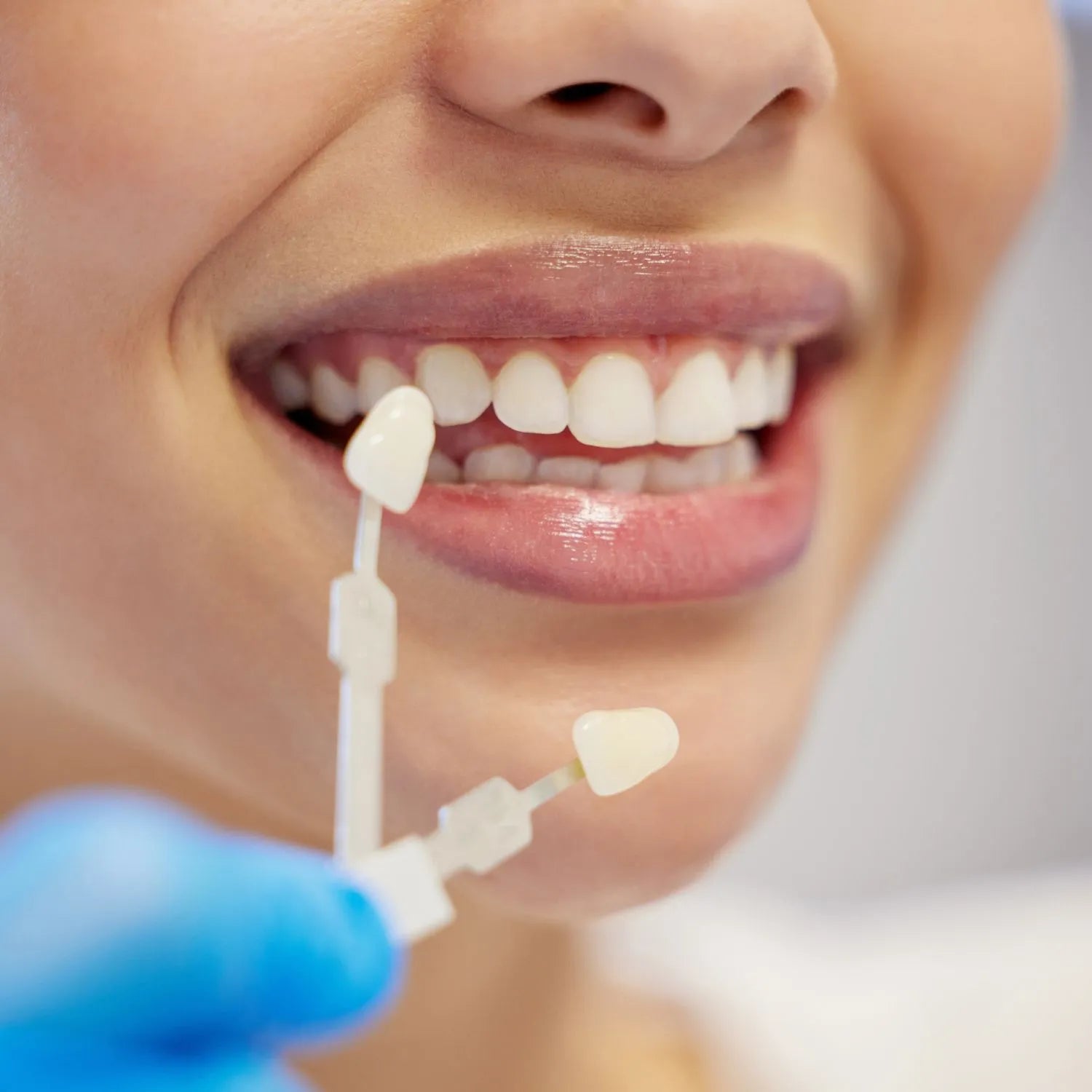 patient choosing colour for an aesthetic composite to be done for her teeth