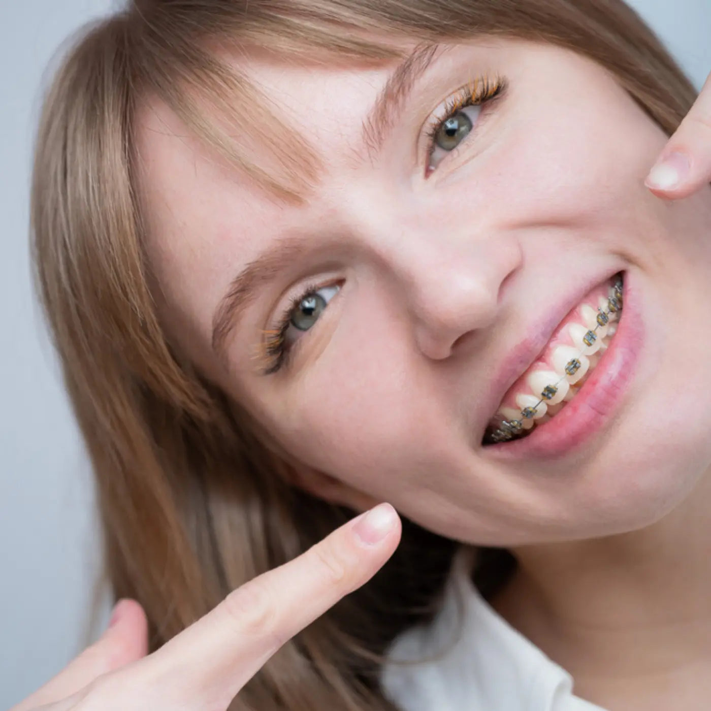 close up girl showing her braces