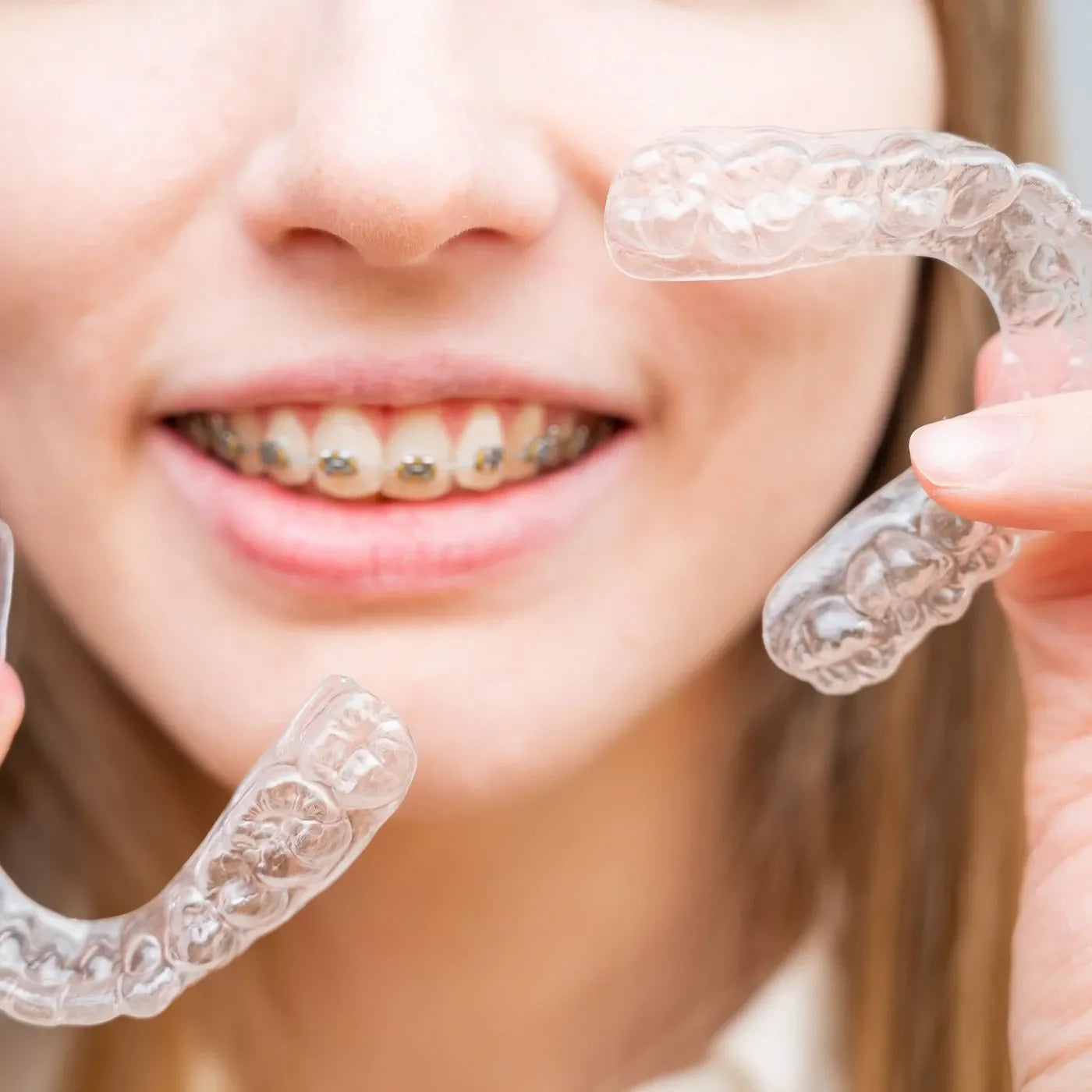 Which Moves Teeth Faster: Braces or Invisalign?