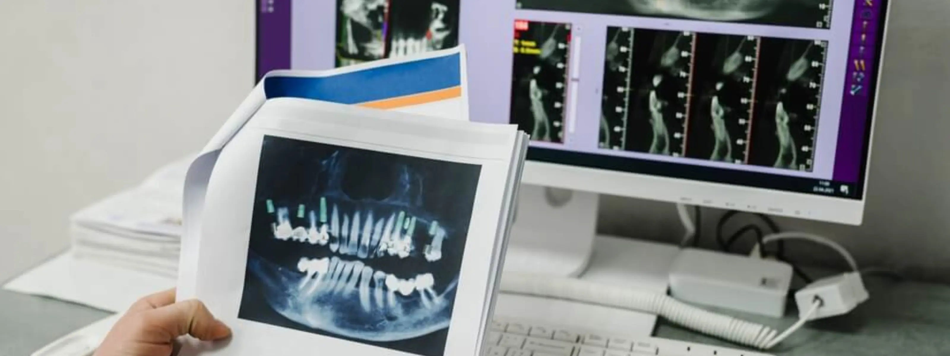 examination anoratic x-ray for orthodontic diagnosis